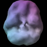 SPECT brain scan of a normal brain